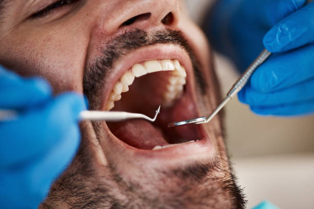 Best Emergency Denture Repair in Vandalia, MO