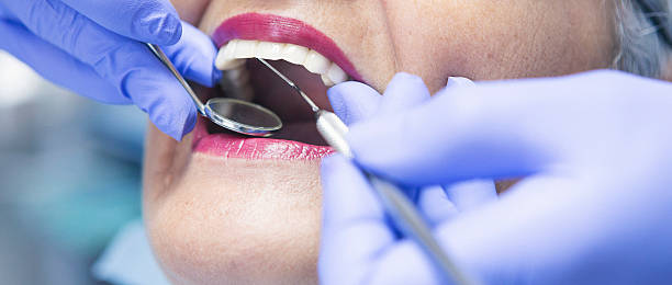Best Emergency Wisdom Teeth Removal in Vandalia, MO